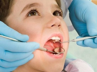 پیشگیری، مهم‌ترین نسخه سلامت دهان و دندان